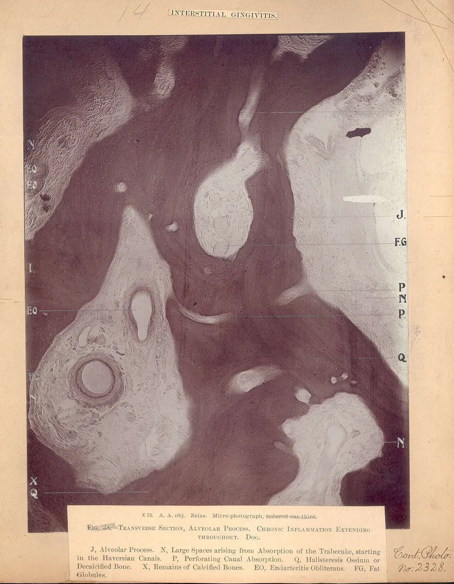 Photomicrography