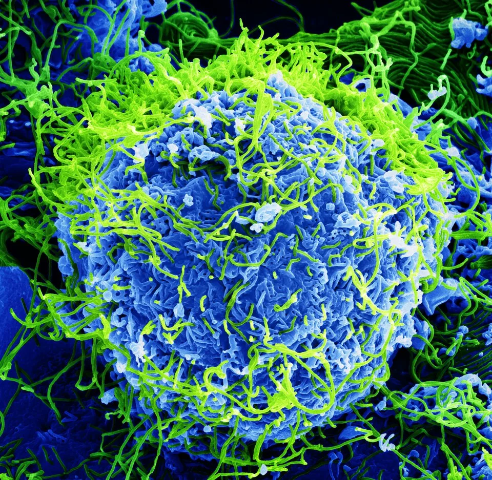 Scanning Electron Micrograph